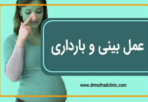 عمل بینی و بارداری - دکتر محمدی مفرد
